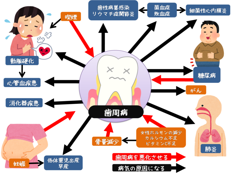 歯周病と全身の関係
