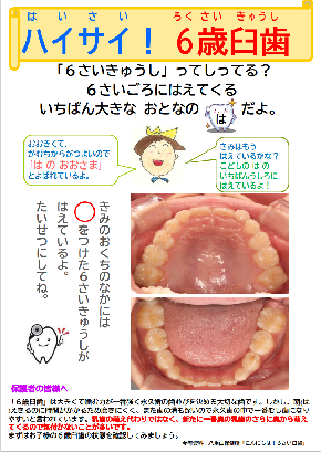 写真：6歳臼歯　チラシ